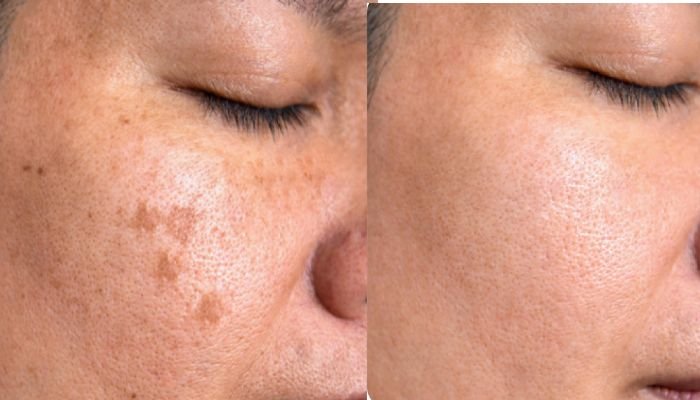 Vibgyor Skin in Burnaby